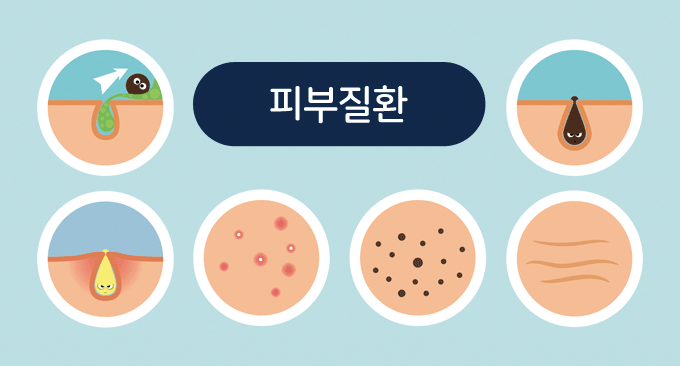 피부질환